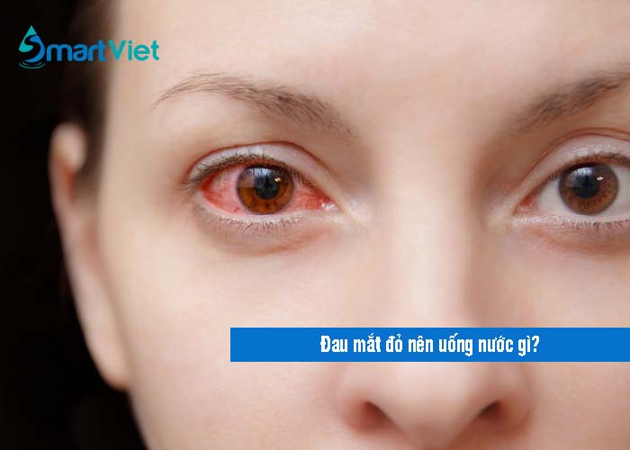 [Tư vấn sức khỏe: Đau mắt đỏ uống nước gì để nhanh khỏi?